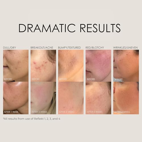 Reflekt 1 Daily Exfoliating Face Wash with Jojoba Beads & Hyaluronic Acid - Sensitive Skin