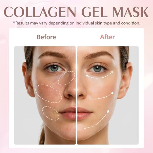 Rose Collagen Face Masks 10 Pack Hydrating & Anti-Aging Skincare