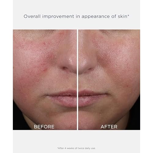 NEOSTRATA CLARIFY Mandelic Clarifying Hydra Gel