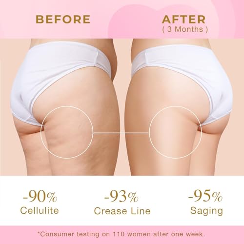 Skin Tightening Cream for Body: Cellulite Cream for Toning and Lifting Thighs, Butt, and Legs ? Reduces Sagging Skin and Enhances Curves for a Youthful Look