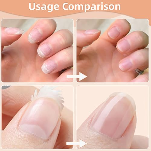 Electric Nail Clipper for Seniors, Professional Automatic Nail Trimmer for Fingernails and Toenails with 2 Speeds, USB Rechargeable & Nail Scraps Storage, Safe Toenail Clippers for Baby, Kids, Women.