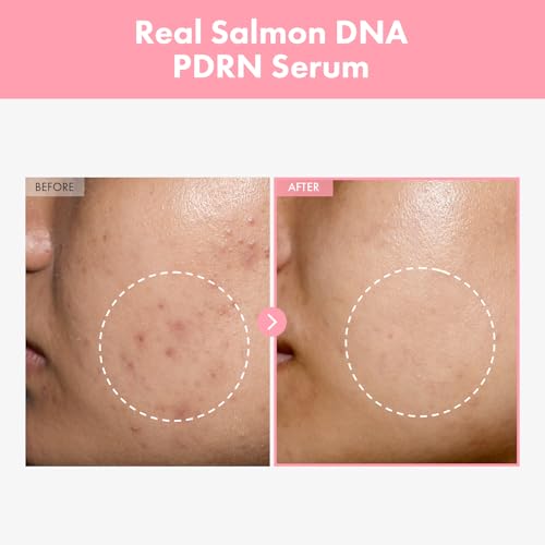 Tone-Refining Skin Care Duo with Arbutin & Peptide Serum for Uneven Skin