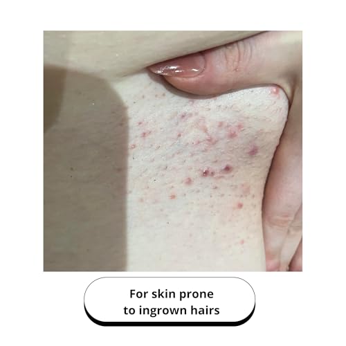 Deep Exfoliating Mitt Body Scrub - Exfoliating Glove Body Scrubber & Skin Cleanser - Body Scrub Gloves for Women & Men - Skin Exfoliator for Body Tool Remover of Dead & Dry Skin