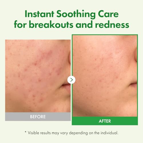 TOSOWOONG Madagascar Centella 70% Soothing & Hydrating Cream for Sensitive Skin