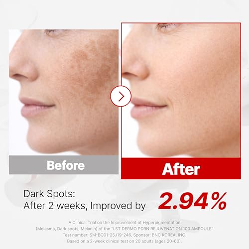 I.st Dermo PDRN 100 Serum 1.01 Fl Oz for Sensitive Skin - Hydrating & Anti-Aging