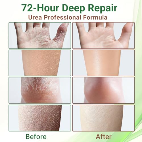 Nail Patches, Nighttime Nail Repair for Damaged, Discolored Nails - 42 Patchs