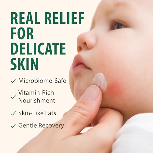 Unscented Grass-Fed Beef Tallow & Honey Balm - 3 Oz Whipped Moisturizer for Dry Skin - Variation of THIS listing