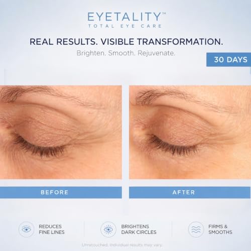Serious Skincare Eyetality Morning Eye Cream for Dark Circles & Puffiness