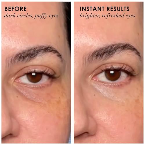 Dermelect Revitalite Eyelid & Dark Circle Corrector- Professional Strength, Anti-Aging Eye Cream with Peptides, Brightening & Tightening Ingredients- Dark Circles, Puffiness, Droopy Eyelids & Wrinkles
