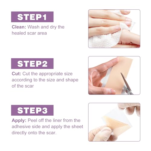 Silicone Scar Sheets 2 Rolls, Silicone Scar Tape (1.6¡± x 120¡± Roll-3M) Pro-Grade Silicone Scar Removal Strips, Reusable, Scar Tape for Wrinkles, Tummy Tuck, C-Section, Keloid, Burn, Acne Scars