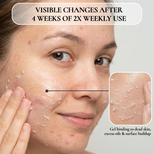 Facial Peeling Gel for Dead Skin Removal - Gentle Exfoliator 4.05 Oz Pack of 2
