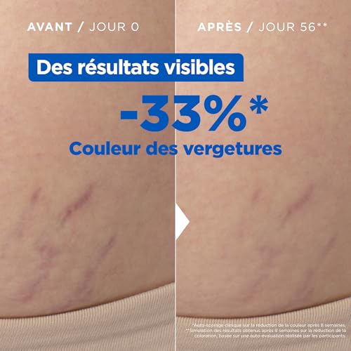 Anti-Stretch Mark Body Oil 100ml - Reduces Visible Color & Texture