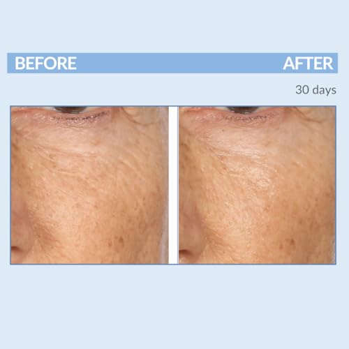 Serious Skincare - Retinol A Eye XR Under Eye Cream Concentrate - Reduce Fine Lines, Dark Circles & Puffiness - Daily Wrinkle Cream - Anti-Aging Skin Care Treatment for Women and Men - 0.5 oz