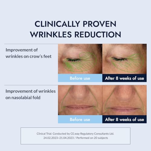 Retinol 0.3% Cream for Face - Anti-Aging Peptide & Plant-Based Ingredients - 0.92 oz - Variation of THIS listing