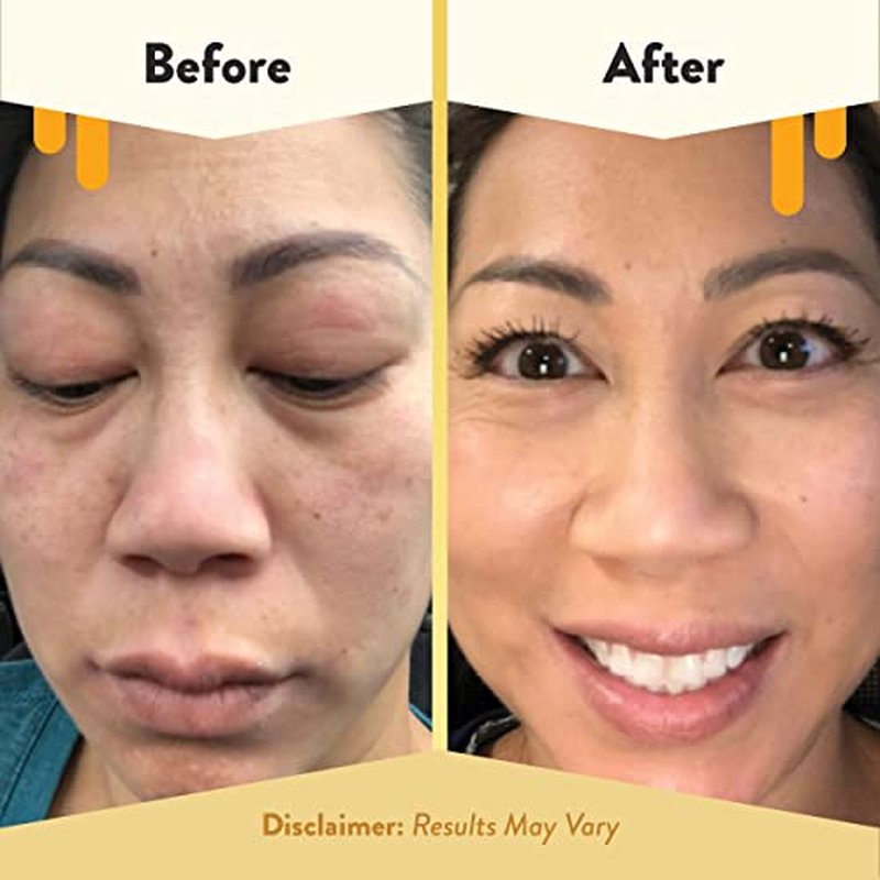 ECZEMA HONEY Oatmeal Facial Cleanser - Soothing Facial Cream - Bundle for Sensitive & Dry Skin - Cruelty Free