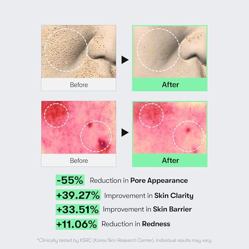 VT COSMETICS Reedle Shot Set - CICA Skincare for All Levels