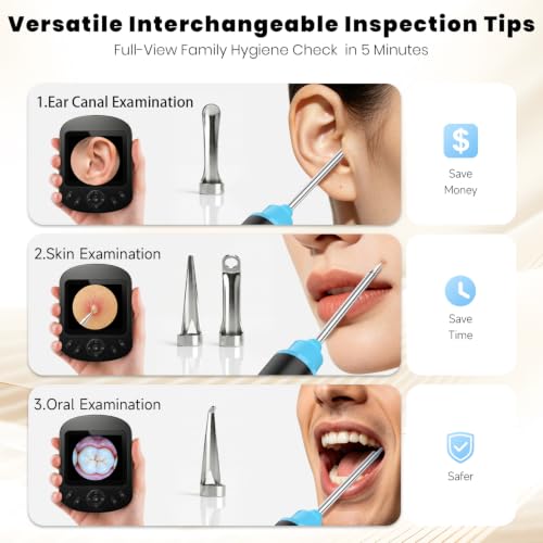 Cklvu Smart Digital Otoscope Ear Camera with 2.8" Screen – Plug & Play, Black (Variation: Black)