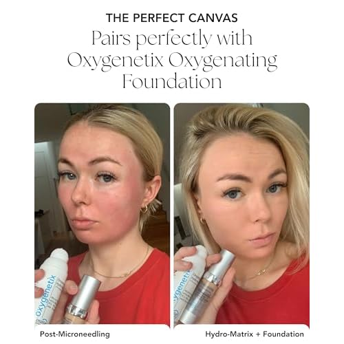 Oxygenetix Oxygenating Hydro-Matrix (1oz) | Lightweight Aloe-Based Face Moisturizer with Hyaluronic Acid for Sensitive, Dry, or Compromised Skin