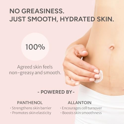 Stretch Mark Cream for Pregnancy & Weight Gain - Korean Skincare, Vegan, Fragrance-Free, 6.76 fl oz