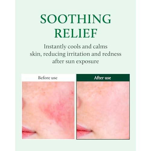 YADAH Cactus Soothing Gel (3.7fl oz) -95% Cactus Extract, Sunburn Relief,After Sun Care,Calm, Cool & Soothe Irritated Skin, Face Redness,Korean Skin Care,Vegan.