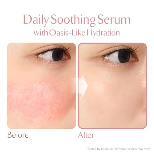 LA MUSE Oasis Soothing Serum(Tube / 6.76 fl oz) | Gel Moisturizer for Face, Instant Soothing with Cica | Hydrolyzed Collagen, Hydro Boost for Deep Hydration & Radiance | Non-Sticky & Fast-Absorbing