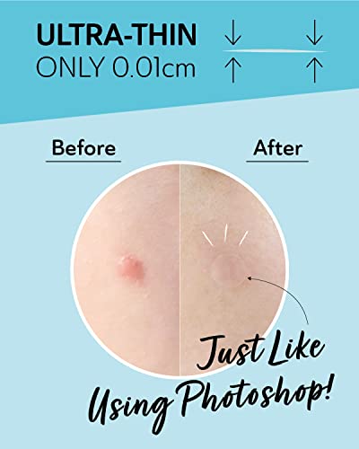 Salicylic Acid Pimple Patches for Face - Hydrocolloid Acne Treatment, Redness Relief, 36 Count
