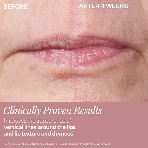 StriVectin Anti-Wrinkle Intensive Eye Cream 0.16 Fl Oz - Targets Wrinkles, Puffiness & Dark Circles