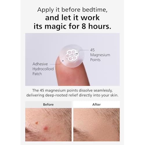EasyDerm Quick Calming Magnesium Patches(10ea) and Real Calming Micropoint Patches(6ea)
