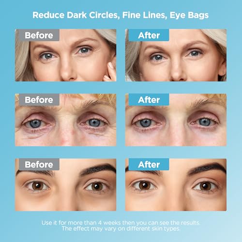 Dongyu Caffeine Eye Cream Set: Eye Serum Kit for Dark Circles Puffiness - Self Care Gifts for Women Birthday Gifts for Her