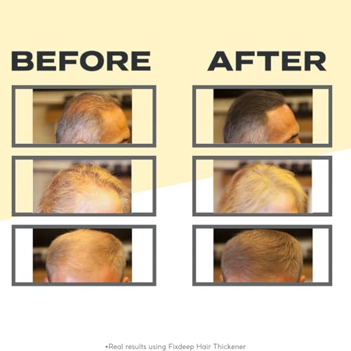 Fixdeep Light Brown Hair Fibers - Waterproof Hair Thickener for Thinning & Bald Spots, 14g