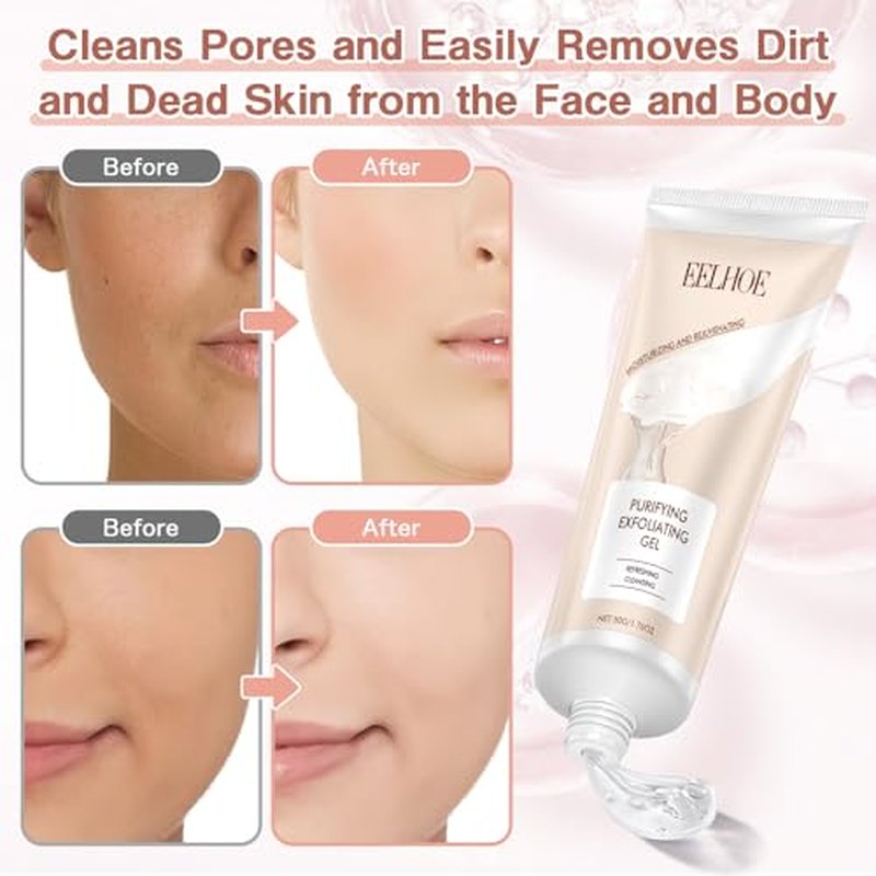 2-in-1 Acne Tools Extractor Scraper with Blackhead Remover Needle for Women Men (1 Pack)
