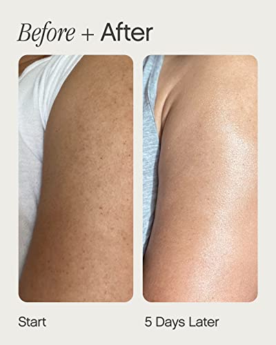 Exfoliating Body Serum with Retinol & AHAs - 5 Fl Oz Pack of 2
