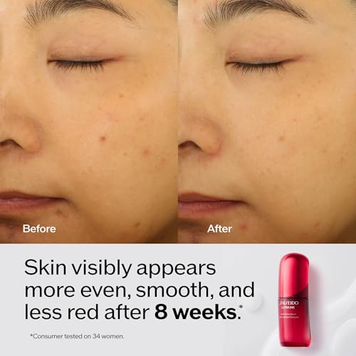 Shiseido Skin Care Set with Serum, Day & Eye Creams - Anti-Aging & SPF 23