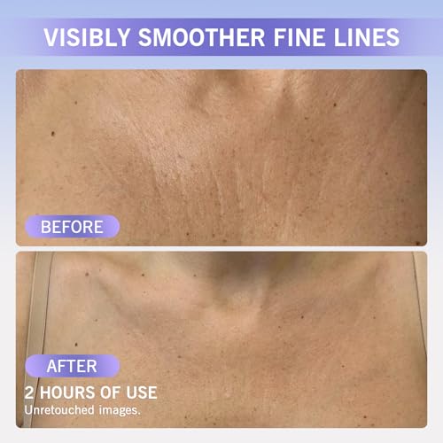 Neck Wrinkle Patches, Reusable Silicone Anti-Wrinkle Pads Set for Neck, Chest and Face, Overnight Use for Smooth Lines, Washable Comfortable Fit, 18 Pieces
