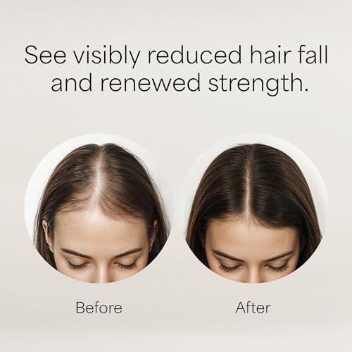 Kismera Hair Loss Control Lotion 4oz - Thinning Hair Treatment for Men & Women
