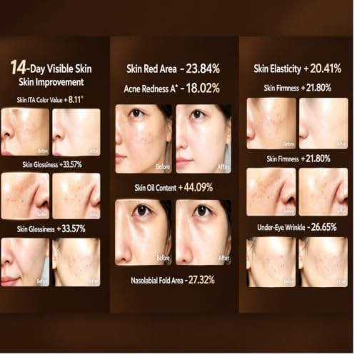 Red Light Therapy Face Mask with 4 Modes and Adjustable Timer for Skin Rejuvenation