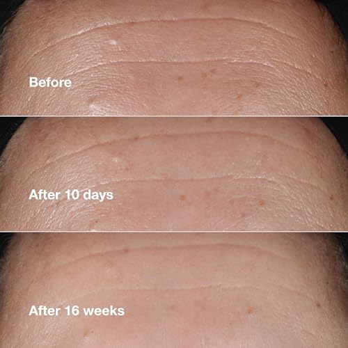 Clinique Smart Clinical Repair Wrinkle Correcting Face Serum 0.34 Fl Oz Mini Travel Size - Anti-Aging Hydrating Serum with Peptides, Hyaluronic Acid & Retinoid
