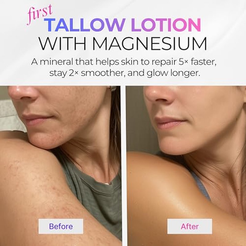 Beef Tallow Body Lotion with Magnesium & Shea Butter - Lightweight, Fast-Absorbing Body Cream with Avocado Oil & Vitamin E - Non-Greasy Moisturizer for Dry, Sensitive Skin - Daily Hydration, 4oz