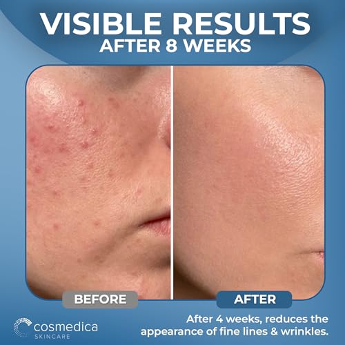Cosmedica Hyaluronic Acid Serum with Vitamin B5 – 2 oz Hydrating Face Serum, Paraben-Free, Lightweight for All Skin Types, Daily Use