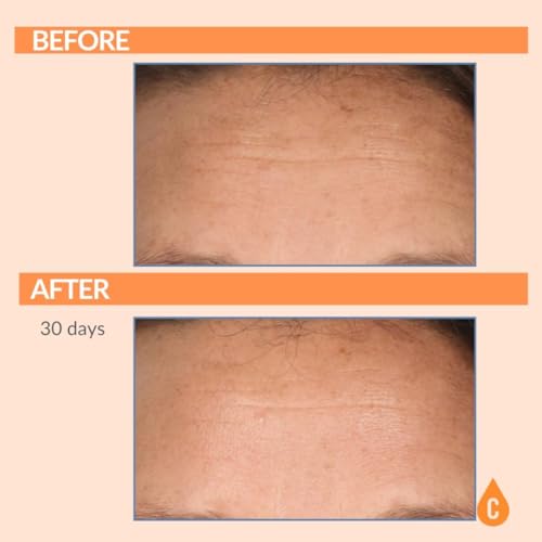 Serious Skincare - Serious-C3 Plasma Vitamin C Restore - Restoration Night Cream for Deep Hydration - Hydrolyzed Collagen - Hydrating Moisture for Face and Neck - 1.7 oz.