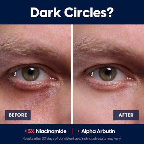 Men's Face Moisturizer for Dark Circles Brightening Anti-Aging Hydrating Cream