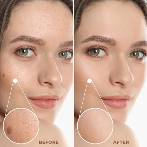 Profusion Cosmetics Lightweight Liquid Foundation for a Flawless and Elegant Radiance, Breathable Makeup that Improves Uneven Skin Tone, Vegan & Cruelty-Free - Fair 1
