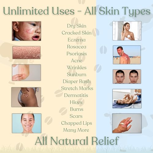 Beef Tallow for Skin - NAKED TALLOW BALM I 1 Ingredient - 100% Grass Fed Beef Tallow | Whole Body & Face | Whipped & UNSCENTED for Sensititve Dry Skin, Babies, Eczema, Psoriasis, Rosacea
