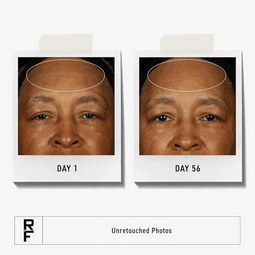 Rodan + Fields Redefine Pore Minimizing Toner | 4.2 fl oz | Deep Exfoliating Cleanser | Visibly Reduces Blackheads | Formulated with Fruit Acids