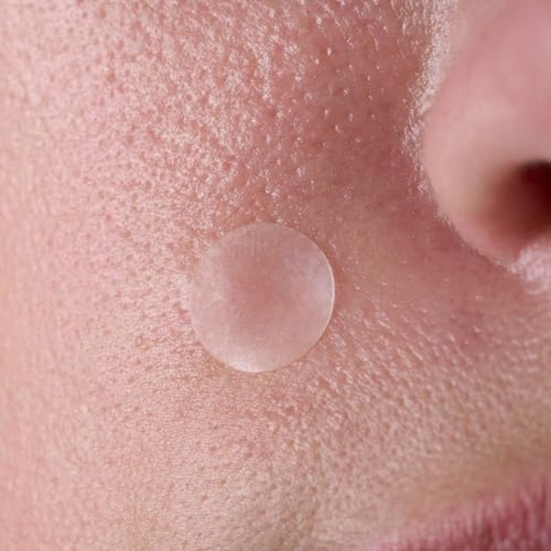 Bliss Clear Genius Blemish Patches ? Salicylic Acid & Zinc for Fast Relief & Prevention, Clarifying Spot Treatment - 3 Pack