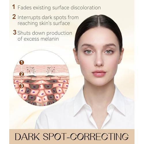 Dark Spot Remover for Face & Body, Dark Spot Corrector with Niacinamide, Fade Cream for Hyperpigmentation, Sun Spots, Age Spots & Melasma, 1.7 fl oz, Skincare Gift for Women, Women¡¯s Day Gift