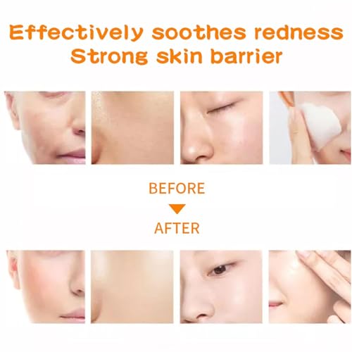 Orange Nourishing Face Mask Set - Hydrating Skin Care for Women & Teens