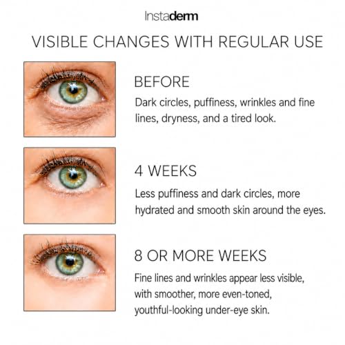 Eye Repair Cream for Dark Circles Puffiness Fine Lines Anti-Aging Niacinamide