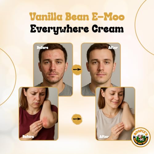 8oz Beef Tallow Body Moisturizer with Organic Emu Oil & Vanilla Bean - Versatile Skin Care