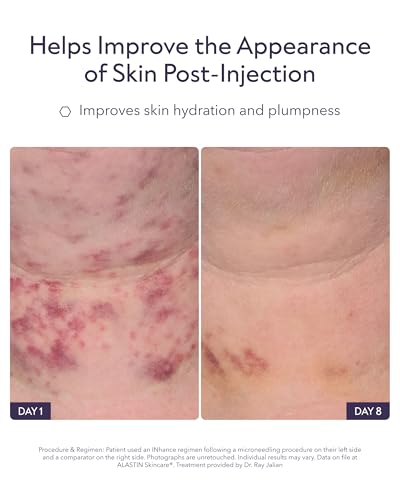 Post-Injection Hydrating Face Serum with TriHex Technology - Cooling Applicator - 0.33 oz (Variation of INhance)